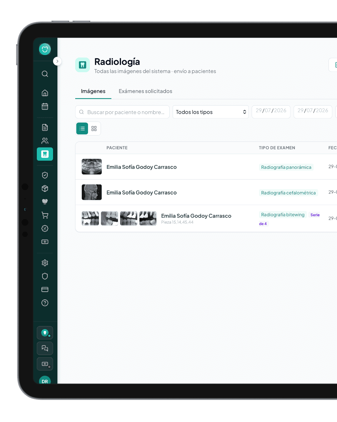 Módulo de radiología de DentalBox con las imágenes del paciente y la serie de bitewing agrupada